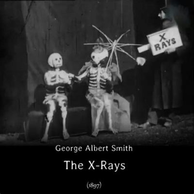  The X-Ray Fiend -  An eerie glimpse into early cinema and scientific wonder!